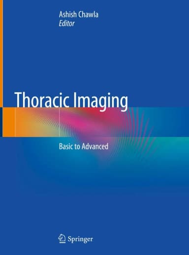 Image of - Thoracic Imaging Basic to Advanced | Hardcover