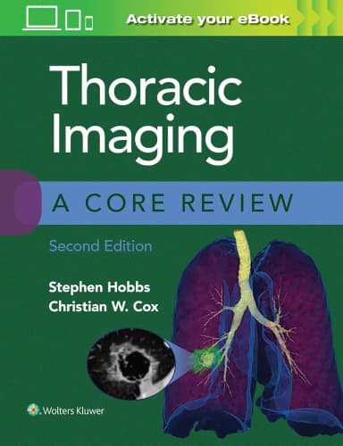 Image of - Thoracic Imaging A Core Review | 2nd Edition | Paperback