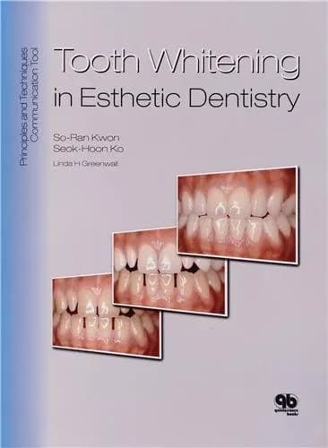 Image of - Tooth Whitening in Esthetic Dentistry | | Hardcover