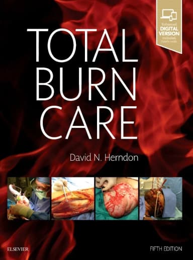 Image of - Total Burn Care | 5th Edition | Hardcover