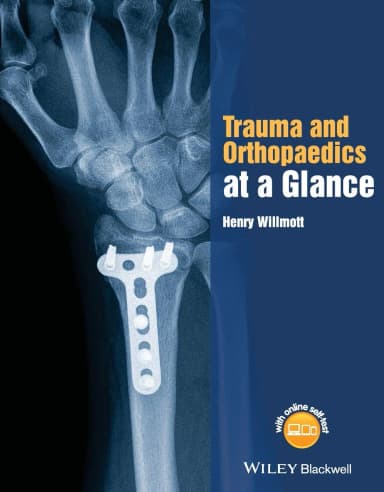 Image of - Trauma and Orthopaedics At A Glance | Paperback