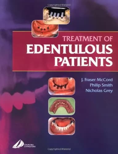 Image of - Treatment of Edentulous Patients | Paperback
