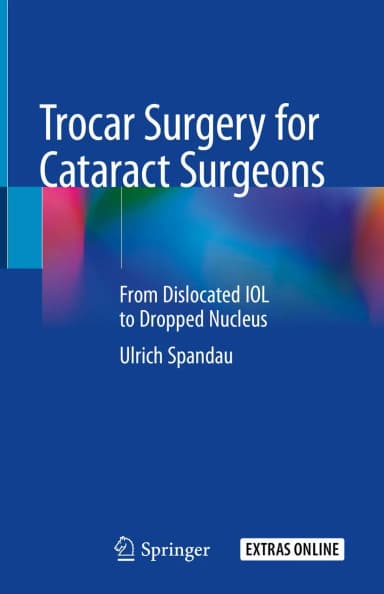 Image of - Trocar Surgery For Cataract Surgeons From Dislocation Iol To Dropped Nucleus | Hardcover