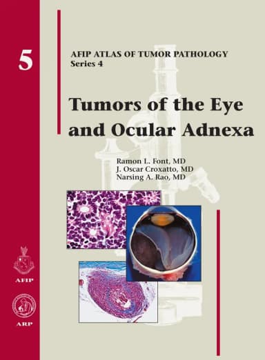 Image of - Tumors of the Eye and Ocular Adnexa 5 | Hardcover