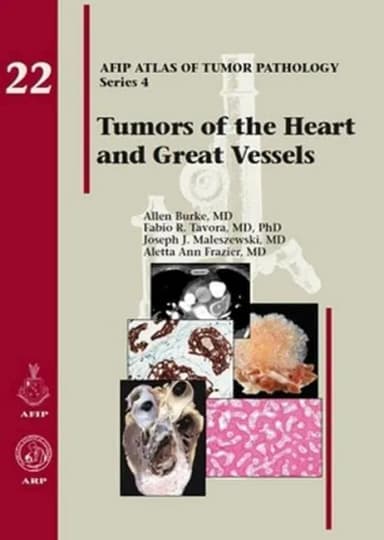 Image of - Tumors of the Heart and Great Vessels 22 | Hardcover