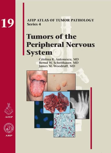 Image of - Tumors of the Peripheral Nervous System 19 | Hardcover