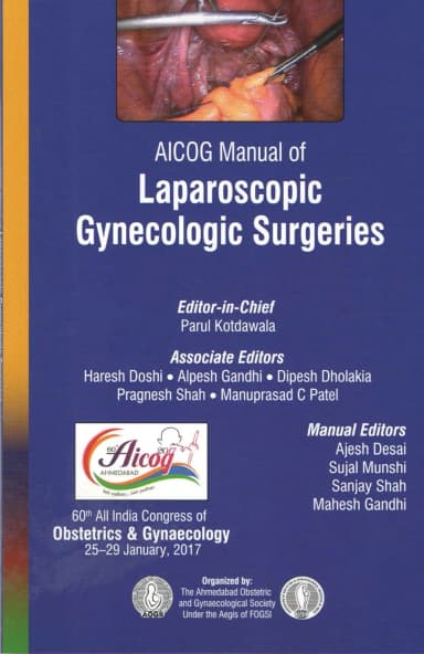 Image of - Aicog Manual Of Laparoscopic Gynecologic Surgeries | Paperback