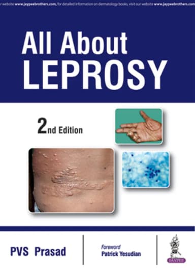 Image of - All About Leprosy | Paperback