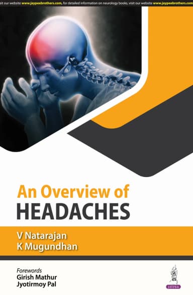 Image of - An Overview Of Headaches | Paperback