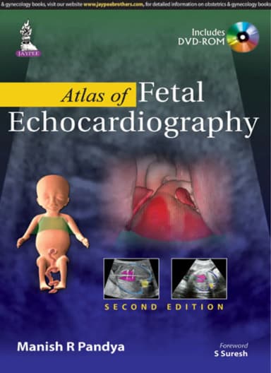 Image of - Atlas Of Fetal Echocardiography | Hardcover