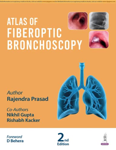 Image of - Atlas Of Fiberoptic Bronchoscopy | 2nd Edition