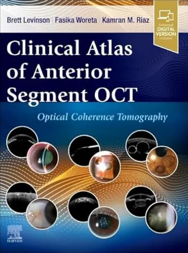 Image of - Clinical Atlas of Anterior Segment OCT: Optical Coherence Tomography -1st Edition