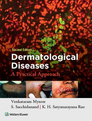 Image of - Dermatological Diseases: A Practical Approach - 2nd Edition