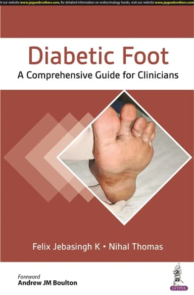 Image of - Diabetic Foot: A Comprehensive Guide For Clinicians | Paperback