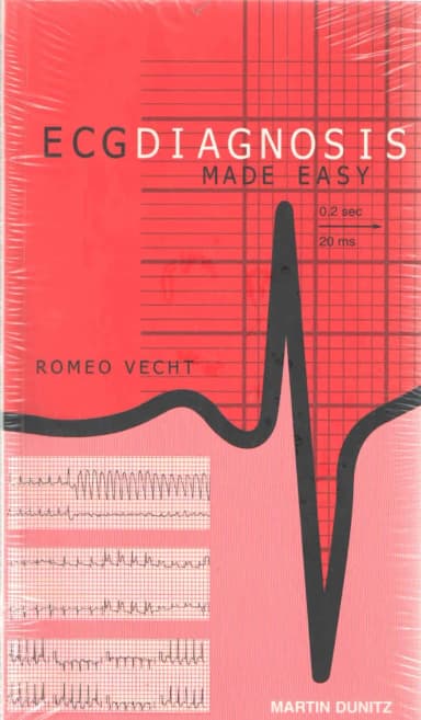 Image of - (Ex)Ecg Diagnosis Made Easy With Cd