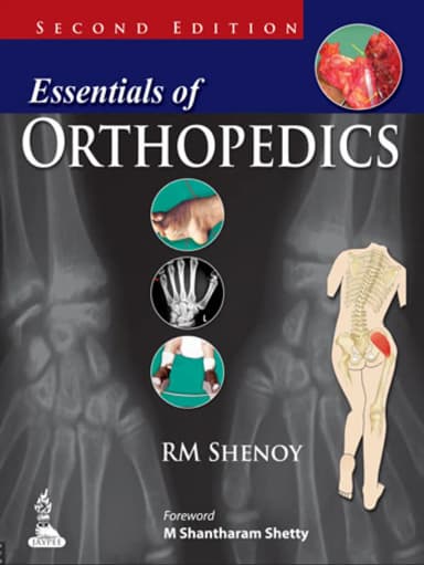 Image of - Essentials Of Orthopedics | Paperback