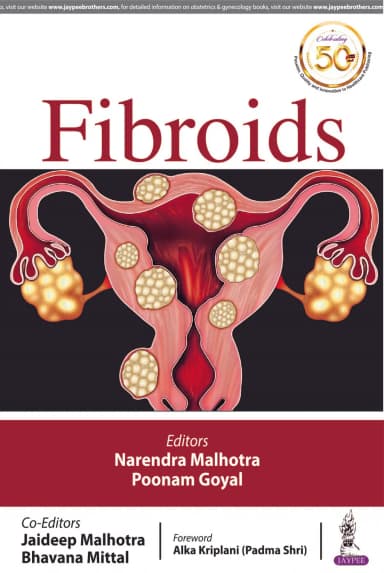 Image of - Fibroids | Paperback