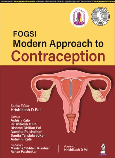 Image of - Fogsi Modern Approach To Contraception | Paperback
