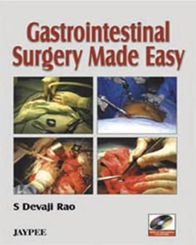 Image of - Gastrointestinal Surgery Made Easy With 2 Intractive Cd-Roms | Paperback
