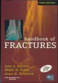 Image of - Handbook Of Fractures