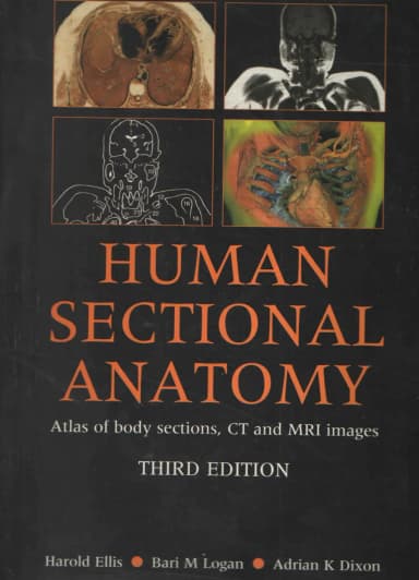 Image of - (Old)Human Sectional Anatomy Atlas Of Body Sections, Ct And Mri Images | Paperback
