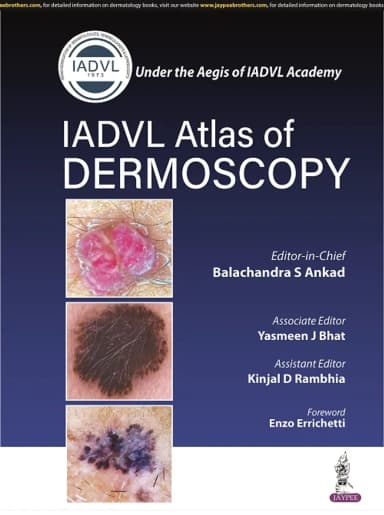 Image of - Iadvl Atlas Of Dermoscopy | Paperback