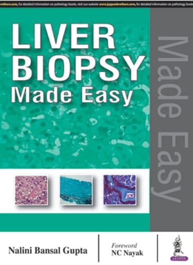 Image of - Liver Biopsy Made Easy | Hardcover