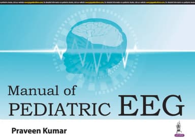Image of - Manual Of Pediatric Eeg | Paperback