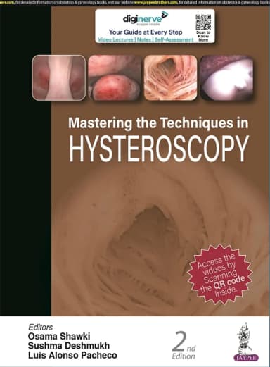 Image of - Mastering The Techniques In Hysteroscopy | Hardcover