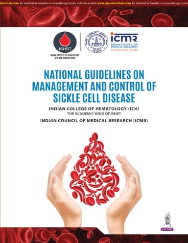 Image of - National Guidelines On Management And Control Of Sickle Cell Disease | Paperback