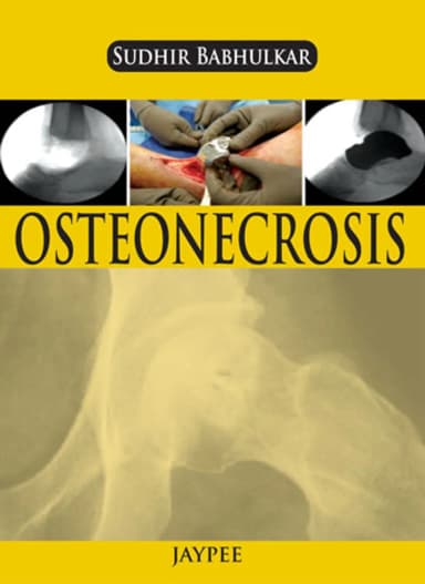 Image of - Osteonecrosis | Paperback