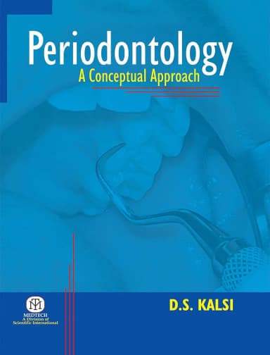 Image of - Periodontology  : A Conceptual Appraoch | Paperback