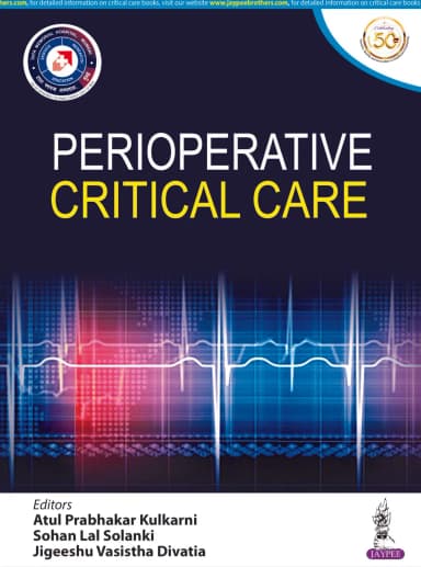 Image of - Perioperative Critical Care | Paperback