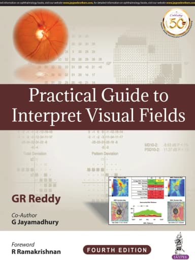 Image of - Practical Guide To Interpret Visual Fields | Hardcover