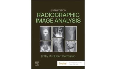 Image of - Radiographic Image Analysis 6th Edition