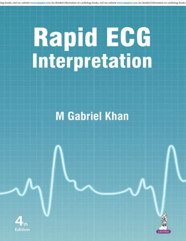 Image of - Rapid Ecg Interpretation | Paperback