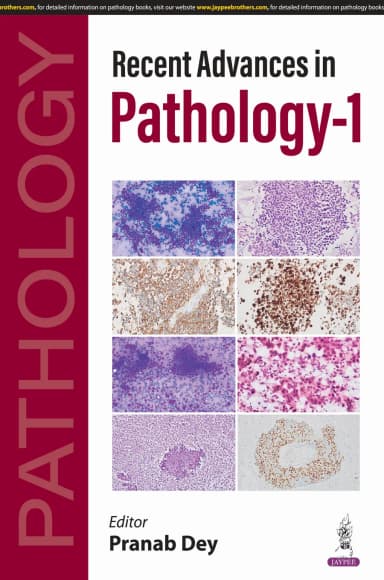 Image of - Recent Advances In Pathology-1 | Paperback