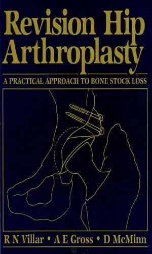 Image of - (Old)Revision Hip Arthroplasty A Practical Approach To Bone Stock Loss