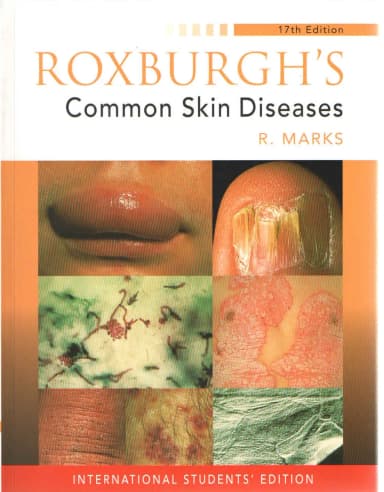 Image of - (Ex)(Old)Roxburgh'S Common Skin Diseases