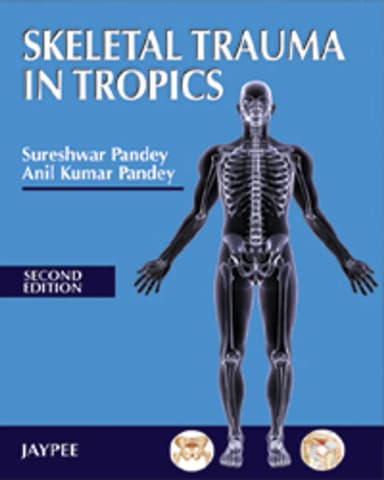 Image of - Skeletal Trauma In Tropics | Paperback