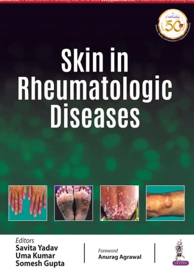 Image of - Skin In Rheumatologic Diseases | Paperback