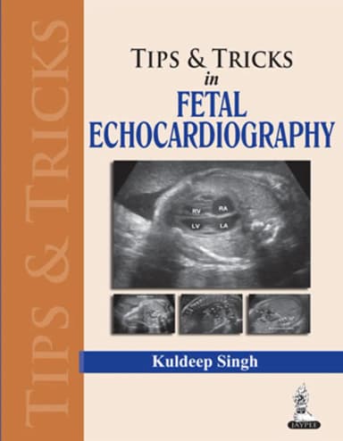 Image of - Tips & Trics In Fetal Echocardiography | Paperback