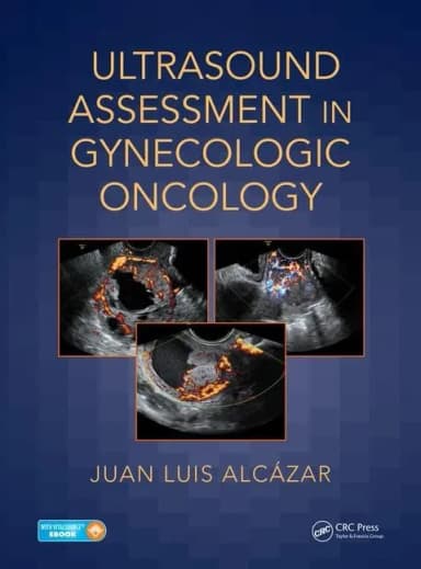 Image of - Ultrasound Assessment in Gynecologic Oncology | Hardcover