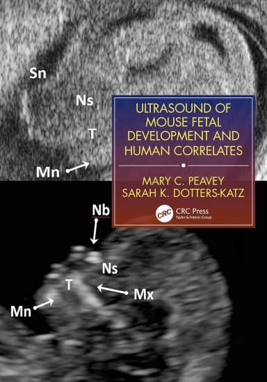 Image of - Ultrasound Of Mouse Fetal Development And Human Correlates | Paperback