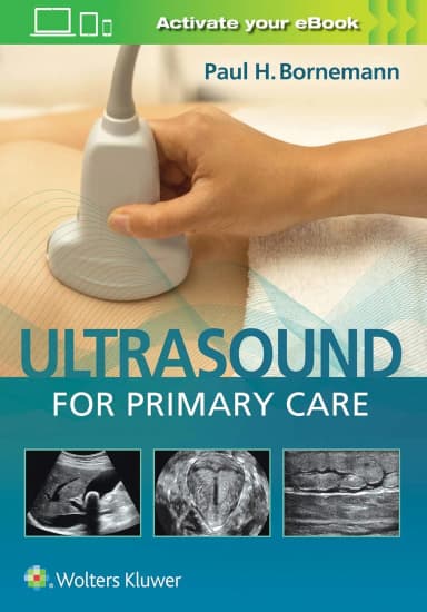 Image of - Ultrasound For Primary Care | Hardcover