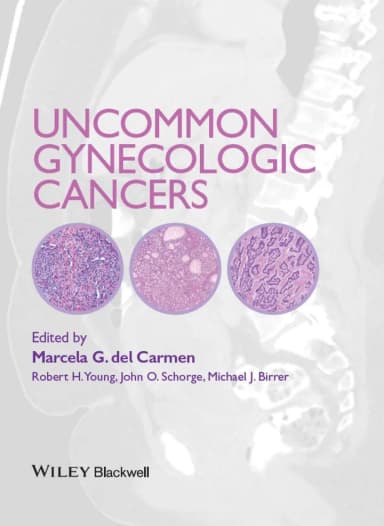 Image of - Uncommon Gynecologic Cancers | Hardcover