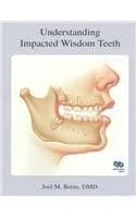 Image of - Understanding Impacted Wisdom Teeth | 2nd Edition | Hardcover