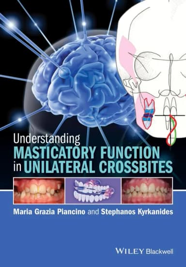 Image of - Understanding Masticatory Function in Unilateral Crossbites | Hardcover