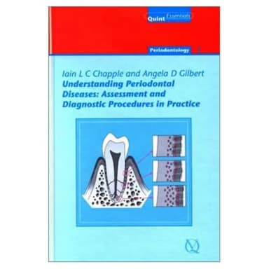 Image of - Understanding Periodontal Diseases | Hardcover