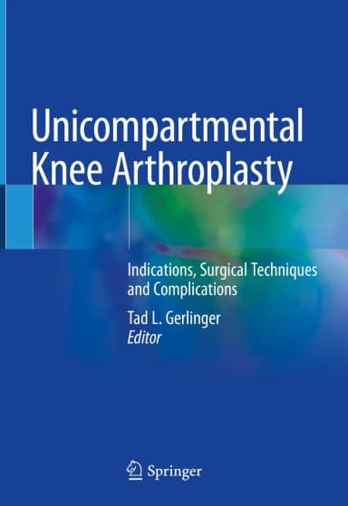 Image of - Unicompartmental Knee Arthroplasty | Hardcover